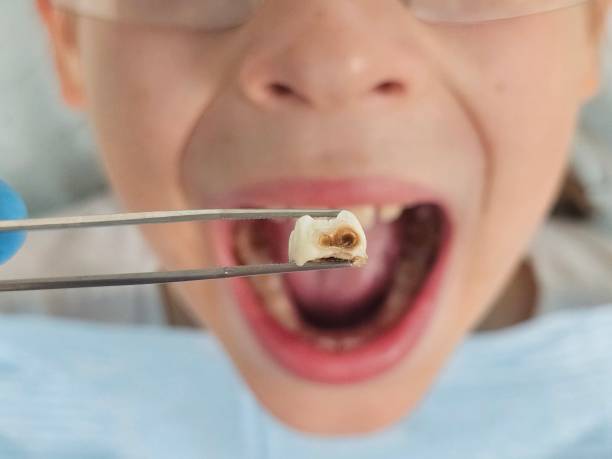 Best Tooth Infection Emergency Dentist  in Vernonia, OR